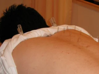 Hands carefully checking the condition around the face as preparation for facial acupuncture